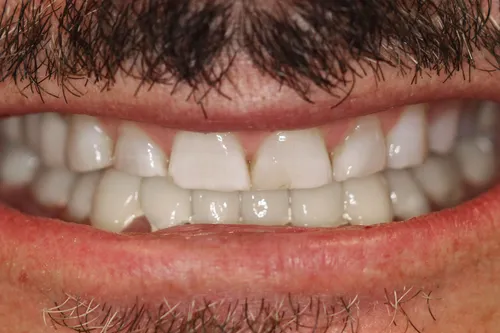Before dental treatment at Oro Valley Dental Arts - Case 3