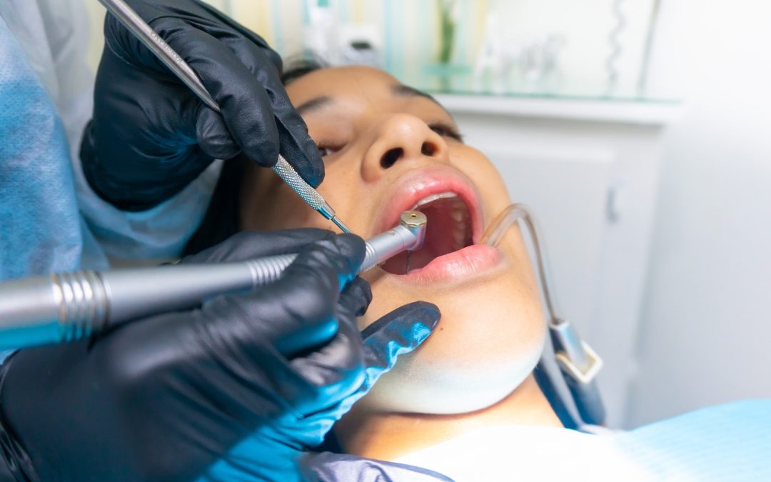 What You Should Do When You Have a Broken Dental Crown