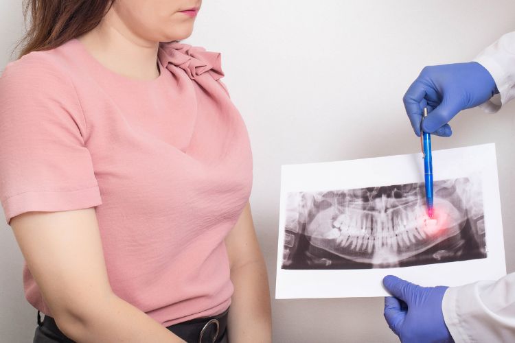 Wisdom Teeth Removal Recovery Tips