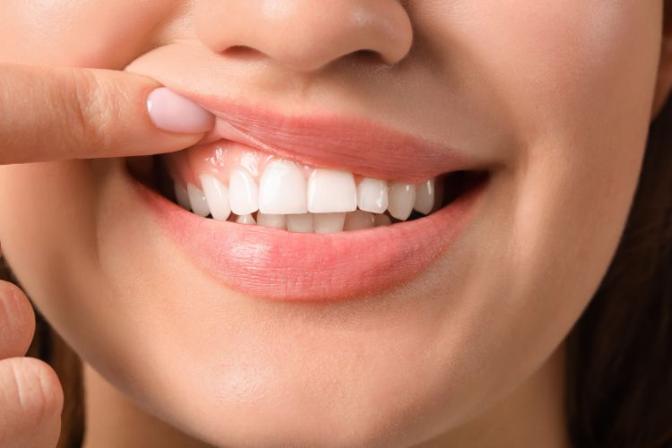 white-teeth