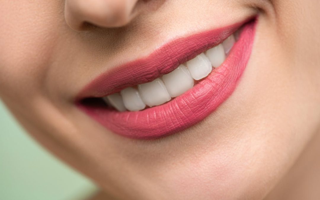 Essential Steps for Achieving the Perfect Smile Makeover