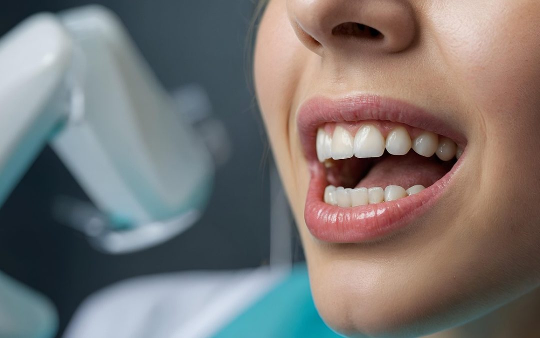 Optimizing Dental Implant Success for Long-Lasting Results