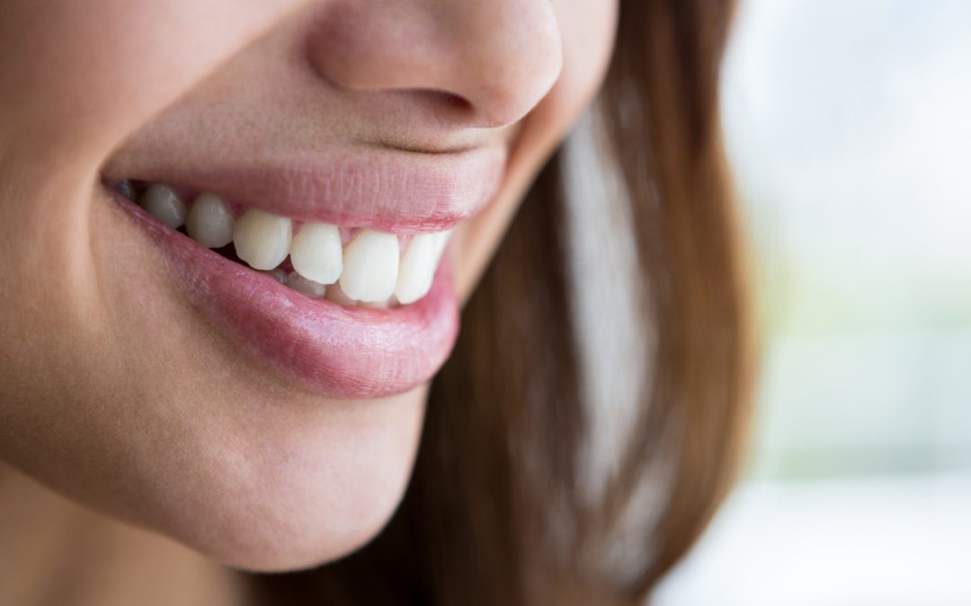 Frequently Asked Questions About Full Crown Teeth