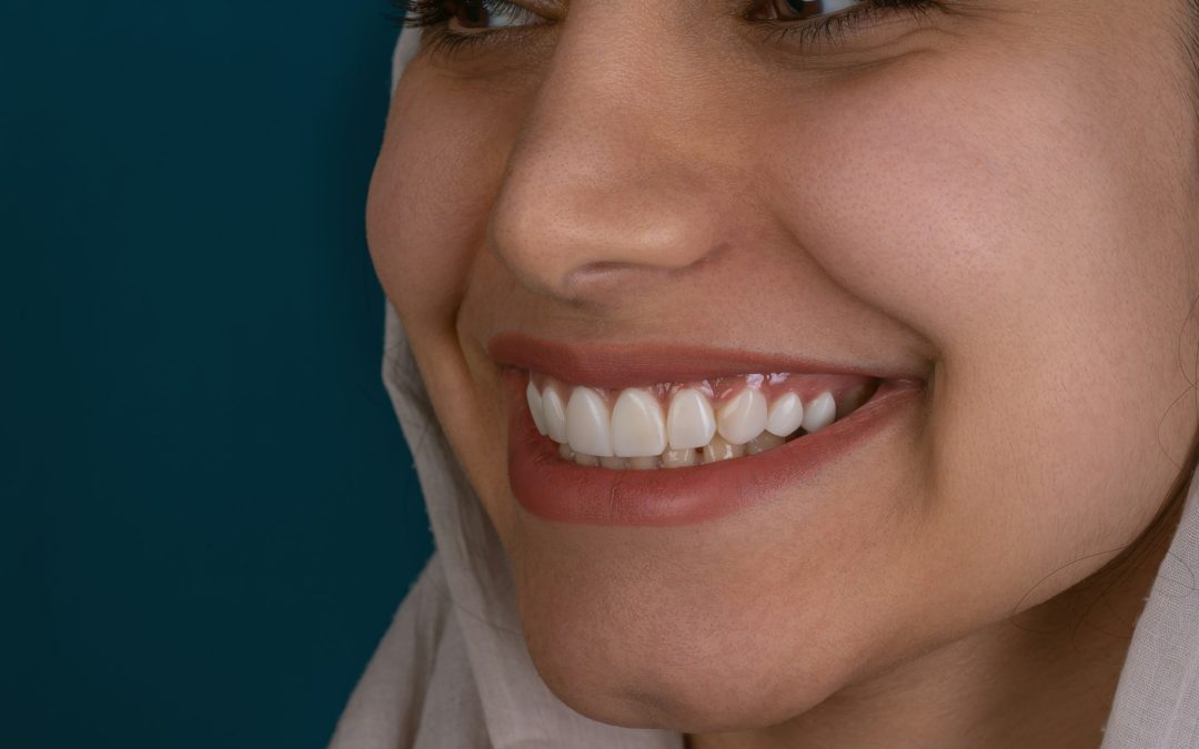 Veneers Dentist