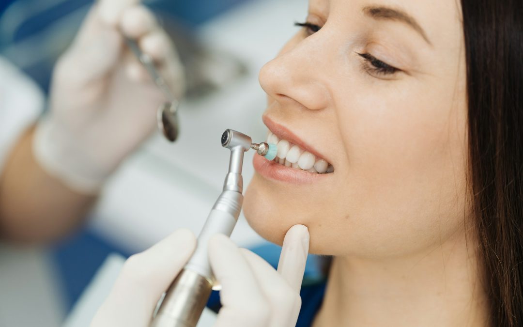 Why Do Veneers Sometimes Change Color: Solutions for a Brighter Smile