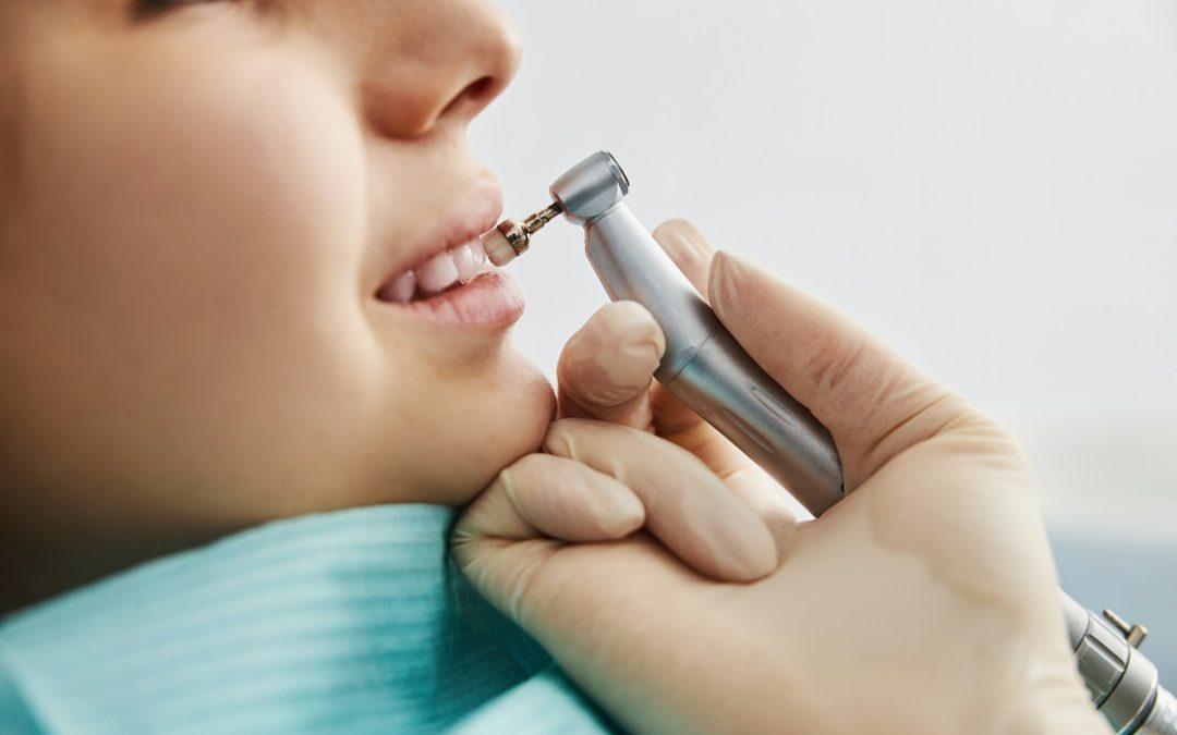 How Professional Teeth Whitening Differs from At-Home Solutions