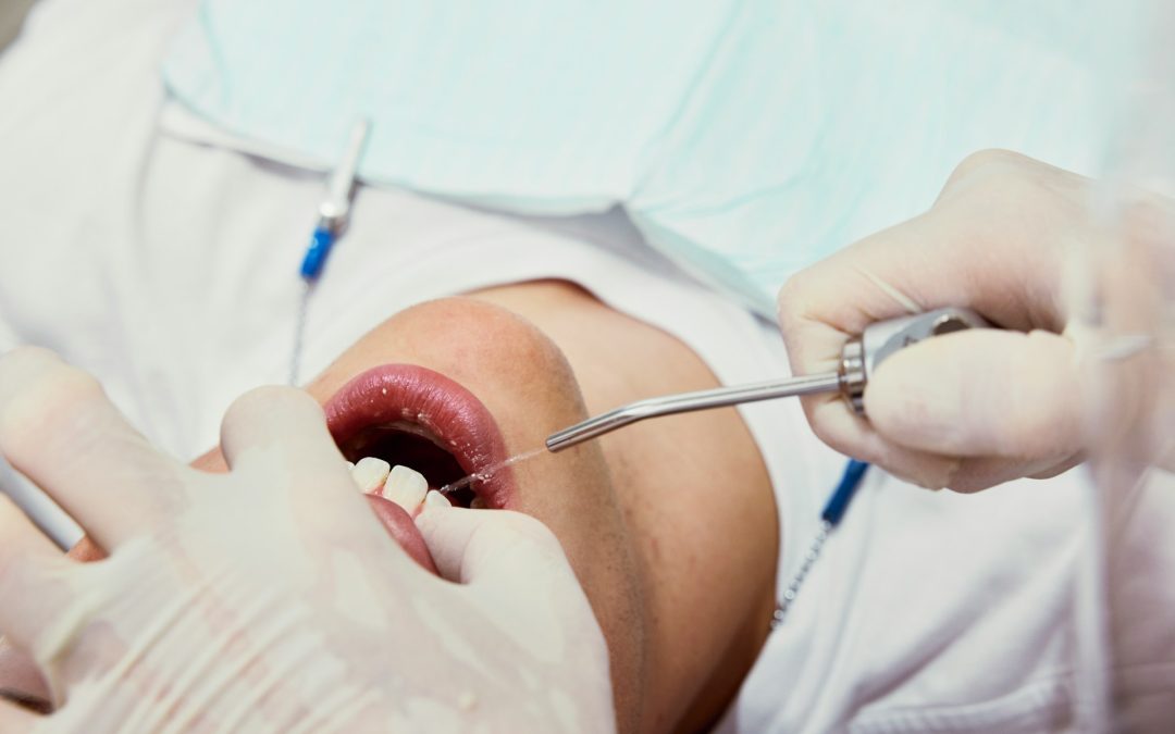 Effective Ways to Combat Gingivitis at Home and Professional Care