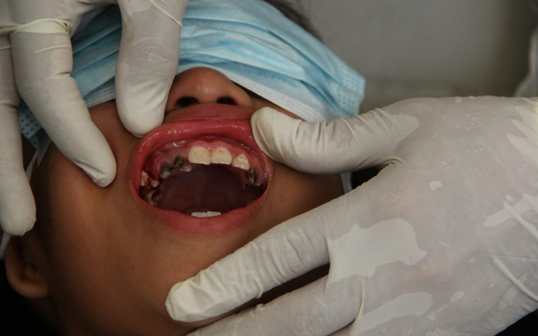 Understanding the Signs of Periodontal Trouble Around the Holidays