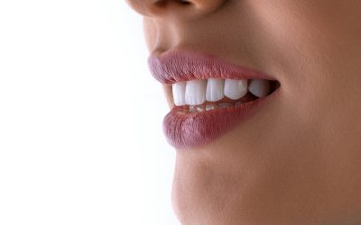 Why Teeth Stain Removal Works Better With Dentist Help